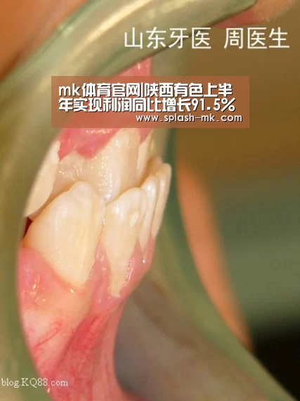 mk体育官网|陕西有色上半年实现利润同比增长91.5%(图3) mk体育官网